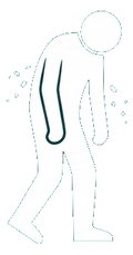 Physical Weakness